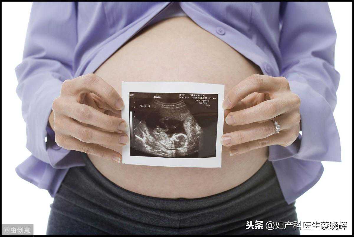 產(chǎn)前檢查不知道怎么做？一文讀懂產(chǎn)檢流程與項(xiàng)目，快收藏